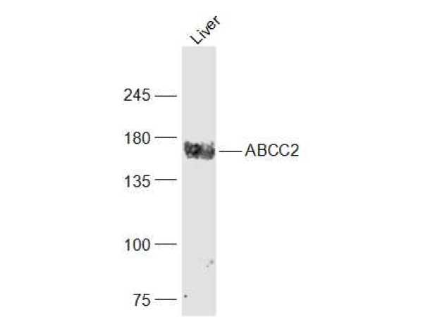 Mouse liver lysates probed with ABCC2\/MRP2 Polyclonal Antibody, Unconjugated (bs-1092R) at 1:1000 dilution and 4˚C overnight incubation. Followed by conjugated secondary antibody incubation at 1:10000 for 60 min at 37˚C.
