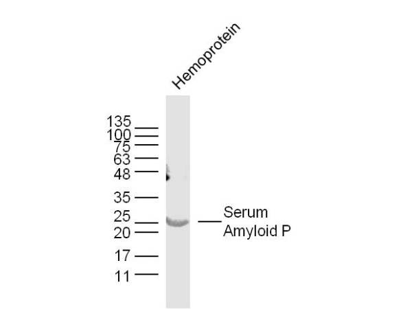 Mouse hemoprotein lysates probed with Serum Amyloid P Polyclonal Antibody, Unconjugated (bs-3765R) at 1:300 dilution and 4˚C overnight incubation. Followed by conjugated secondary antibody incubation at 1:10000 for 60 min at 37˚C.
