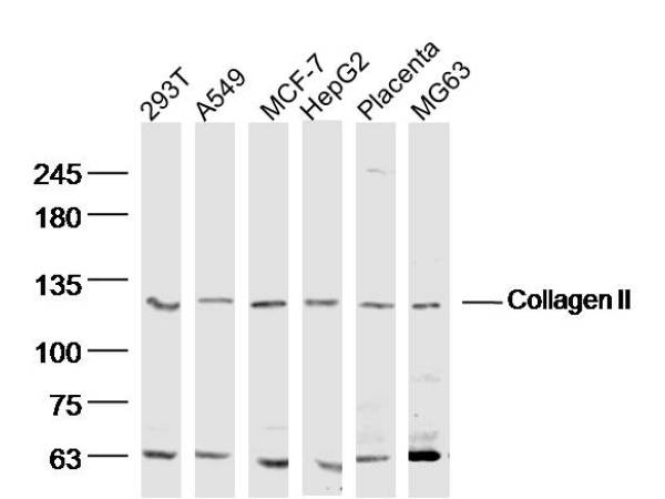 Lane 1: Human 293T lysates; Lane 2: Human A549 lysates; Lane 3: Human MCF-7 lysates; Lane 4: Human HepG2 lysates; Lane 5: Mouse Placenta lysates; Lane 6: Human Mg63 lysates probed with Collagen II Polyclonal Antibody, Unconjugated (bs-0709R) at 1:300 dilution and 4˚C overnight incubation. Followed by conjugated secondary antibody incubation at 1:10000 for 60 min at 37˚C. Lane 1: Human 293T lysates; Lane 2: Human A549 lysates; Lane 3: Human MCF-7 lysates; Lane 4: Human HepG2 lysates; Lane 5: Mouse Placenta lysates; Lane 6: Human Mg63 lysates probed with Collagen II Polyclonal Antibody, Unconjugated (bs-0709R) at 1:300 dilution and 4˚C overnight incubation. Followed by conjugated secondary antibody incubation at 1:10000 for 60 min at 37˚C.
