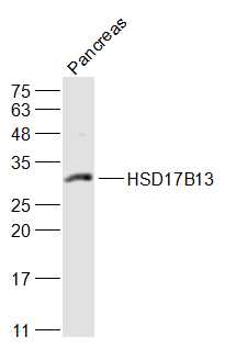 Rat pancreas lysates probed with HSD17B13 Polyclonal Antibody, Unconjugated (bs-17402R) at 1:1000 dilution and 4˚C overnight incubation. Followed by conjugated secondary antibody incubation at 1:20000 for 60 min at 37˚C.