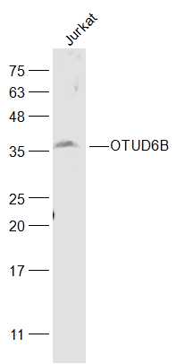 Jurkat cell lysates probed with OTUD6B Polyclonal Antibody, Unconjugated (bs-17567R) at 1:500 dilution and 4˚C overnight incubation. Followed by conjugated secondary antibody incubation at 1:20000 for 60 min at 37˚C. Jurkat cell lysates probed with OTUD6B Polyclonal Antibody, Unconjugated (bs-17567R) at 1:500 dilution and 4˚C overnight incubation. Followed by conjugated secondary antibody incubation at 1:20000 for 60 min at 37˚C.