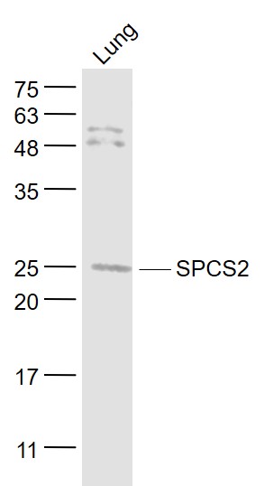 Mouse Lung lysates probed with SPCS2 Polyclonal Antibody, Unconjugated (bs-17641R) at 1:300 dilution and 4˚C overnight incubation. Followed by conjugated secondary antibody incubation at 1:20000 for 60 min at 37˚C.
