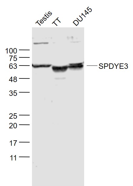 Lane 1: Mouse testis lysates;Lane 2: TT cell lysates; Lane 3: DU145 cell lysates probed with SPDYE3 Polyclonal Antibody, Unconjugated (bs-17464R) at 1:300 dilution and 4˚C overnight incubation. Followed by conjugated secondary antibody incubation at 1:20000 for 60 min at 37˚C.