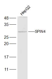 HepG2 cell lysates probed with SPIN4 Polyclonal Antibody, Unconjugated (bs-17668R) at 1:300 dilution and 4˚C overnight incubation. Followed by conjugated secondary antibody incubation at 1:20000 for 60 min at 37˚C.