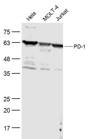 Lane 1: Hela Cell lysates; Lane 2: Molt-4 Cell Lysates; Lane 3: Jurkat Cell Lysates; Probed with PD-1 Polyclonal Antibody, unconjugated (bs-1867R) at 1:500 overnight at 4\u00b0C followed by a conjugated secondary antibody for 60 minutes at 37\u00b0C.