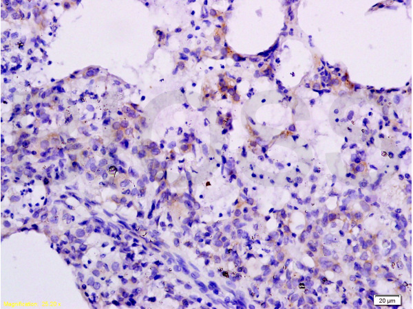 Formalin-fixed and paraffin embedded rat lung labeled with Anti-CXCL10 Polyclonal Antibody, Unconjugated (bs-1502R) at 1:200 followed by conjugation to the secondary antibody and DAB staining.
