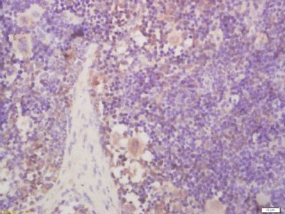 Paraformaldehyde-fixed, paraffin-embedded mouse spleen tissue; Antigen retrieval by boiling in sodium citrate buffer(pH6) for 15 minutes; Block endogenous peroxidase by 3% hydrogen peroxide for 30 minutes; Blocking buffer (normal goat serum) incubation at 37°C for 20 minutes; Antibody incubation with NROB2 Polyclonal Antibody, Unconjugated (bs-4311R) at 1:200 overnight at 4°C, followed by a conjugated secondary antibody and DAB staining.