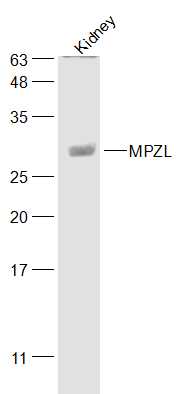 Mouse kidney lysates probed with MPZL Polyclonal Antibody, Unconjugated (bs-17744R) at 1:500 dilution and 4˚C overnight incubation. Followed by conjugated secondary antibody incubation at 1:20000 for 60 min at 37˚C.
