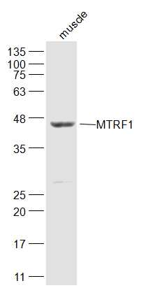 Mouse muscle lysates probed with MTRF1 Polyclonal Antibody, Unconjugated (bs-17893R) at 1:300 dilution and 4˚C overnight incubation. Followed by conjugated secondary antibody incubation at 1:20000 for 60 min at 37˚C.