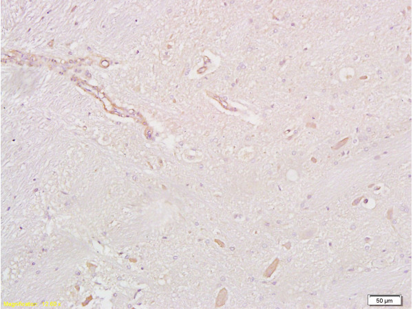 Formalin-fixed and paraffin embedded rat brain tissue labeled with Anti-GLP-1R Polyclonal Antibody, Unconjugated (bs-1559R) at 1:200 followed by conjugation to the secondary antibody and DAB staining\n