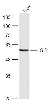 Mouse Liver lysates probed with LGI2 Polyclonal Antibody, Unconjugated (bs-18235R) at 1:300 dilution and 4˚C overnight incubation. Followed by conjugated secondary antibody incubation at 1:20000 for 60 min at 37˚C.