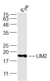 Mouse eye lysates probed with LIM2 Polyclonal Antibody, Unconjugated (bs-18272R) at 1:300 dilution and 4˚C overnight incubation. Followed by conjugated secondary antibody incubation at 1:20000 for 60 min at 37˚C.