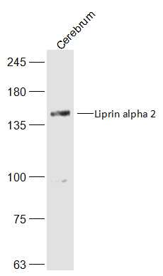 Mouse Cerebrum lysates probed with Liprin alpha 2 Polyclonal Antibody, Unconjugated (bs-18299R) at 1:300 dilution and 4˚C overnight incubation. Followed by conjugated secondary antibody incubation at 1:20000 for 60 min at 37˚C.