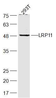 293T cell lysates probed with LRP11 Polyclonal Antibody, Unconjugated (bs-18361R) at 1:300 dilution and 4˚C overnight incubation. Followed by conjugated secondary antibody incubation at 1:20000 for 60 min at 37˚C.