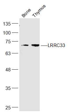 Lane 1: Rat bone lysates; Lane 2: Rat thymuslysates probed with SIRT4 Polyclonal Antibody, Unconjugated (bs-7537R) at 1:1000 dilution and 4˚C overnight incubation. Followed by conjugated secondary antibody incubation at 1:20000 for 60 min at 37˚C.