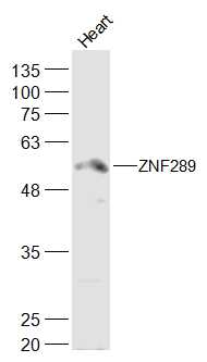 Mouse heart lysates probed with ZNF289 Polyclonal Antibody, Unconjugated (bs-18504R) at 1:300 dilution and 4˚C overnight incubation. Followed by conjugated secondary antibody incubation at 1:20000 for 60 min at 37˚C.