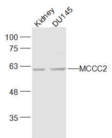 Lane 1: Mouse kidney lysates; Lane 2: DU145 cell lysates probed with MCCC2 Polyclonal Antibody, Unconjugated (bs-18719R) at 1:1000 dilution and 4˚C overnight incubation. Followed by conjugated secondary antibody incubation at 1:20000 for 60 min at 37˚C.