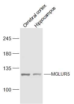 Lane 1: Mouse Cerebral cortex lysates; Lane 2: Mouse hippocampus lysates probed with MGLUR5 Polyclonal Antibody, Unconjugated (bs-18801R) at 1:1000 dilution and 4˚C overnight incubation. Followed by conjugated secondary antibody incubation at 1:20000 for 60 min at 37˚C.