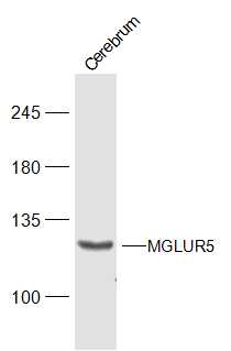 Mouse cerebrum lysates probed with MGLUR5 Polyclonal Antibody, Unconjugated (bs-18801R) at 1:1000 dilution and 4˚C overnight incubation. Followed by conjugated secondary antibody incubation at 1:20000 for 60 min at 37˚C.