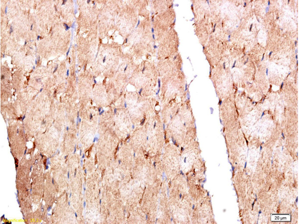Formalin-fixed and paraffin embedded rat myocardium labeled with Anti-MuRF1\/Trim63 Polyclonal Antibody, Unconjugated (bs-0649R) at 1:200 followed by conjugation to the secondary antibody and DAB staining.