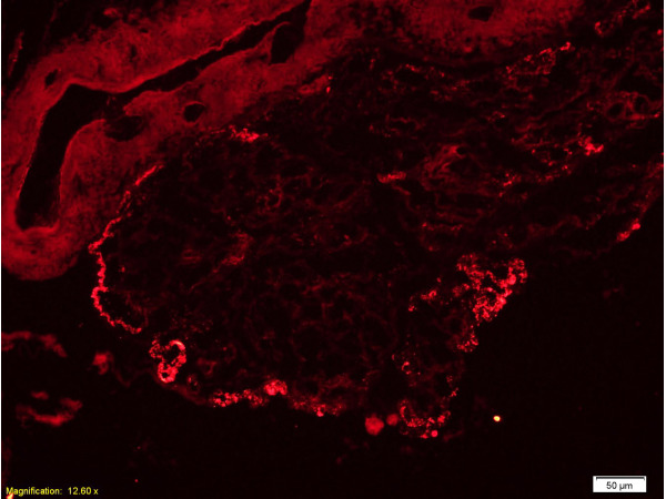 Formalin-fixed and rat pancreas tissue labeled with Anti-FN/Fibronectin 1 Polyclonal Antibody, Unconjugated (bs-0666R) at 1:200 followed by conjugation to the secondary antibody, Goat Anti-Rabbit IgG, PE conjugated(bs-0295G-PE)
