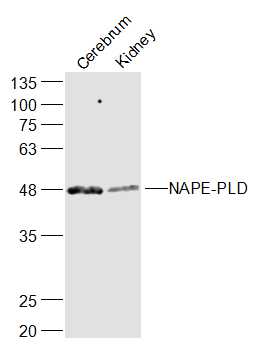 Lane 1: Mouse Cerebrum lysates; Lane 2: Mouse kidney lysates probed with NAPE-PLD Polyclonal Antibody, Unconjugated (bs-19015R) at 1:300 dilution and 4˚C overnight incubation. Followed by conjugated secondary antibody incubation at 1:20000 for 60 min at 37˚C.