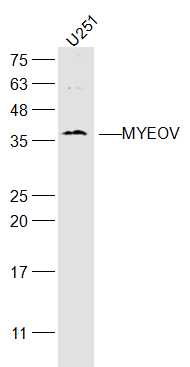 U251 cell lysates probed with MYEOV Polyclonal Antibody, Unconjugated (bs-19145R) at 1:300 dilution and 4˚C overnight incubation. Followed by conjugated secondary antibody incubation at 1:20000 for 60 min at 37˚C.