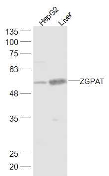 Lane 1: HepG2 cell lysates; Lane 2: Mouse Liver lysates probed with ZGPAT Polyclonal Antibody, Unconjugated (bs-19161R) at 1:300 dilution and 4˚C overnight incubation. Followed by conjugated secondary antibody incubation at 1:20000 for 60 min at 37˚C.