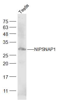 Mouse testis lysates probed with NIPSNAP1 Polyclonal Antibody, Unconjugated (bs-19252R) at 1:300 dilution and 4˚C overnight incubation. Followed by conjugated secondary antibody incubation at 1:20000 for 60 min at 37˚C.