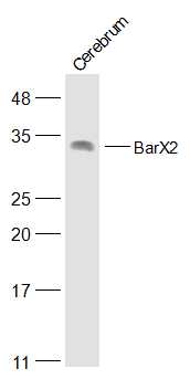 Mouse cerebrum lysates probed with BarX2 Polyclonal Antibody, Unconjugated (bs-19273R) at 1:500 dilution and 4˚C overnight incubation. Followed by conjugated secondary antibody incubation at 1:20000 for 60 min at 37˚C.