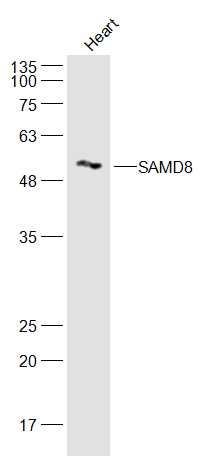 Mouse heart lysates probed with SAMD8 Polyclonal Antibody, Unconjugated (bs-19376R) at 1:500 dilution and 4˚C overnight incubation. Followed by conjugated secondary antibody incubation at 1:20000 for 60 min at 37˚C.