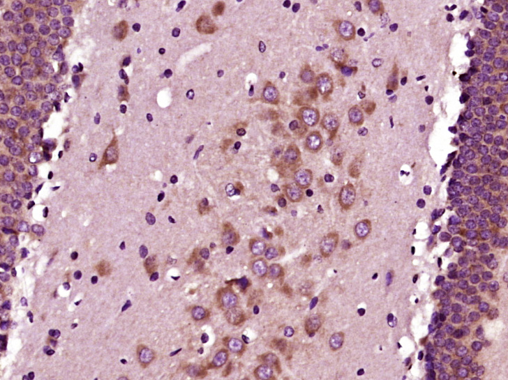 Paraformaldehyde-fixed, paraffin embedded Rat brain; Antigen retrieval by boiling in sodium citrate buffer (pH6.0) for 15min; Block endogenous peroxidase by 3% hydrogen peroxide for 20 minutes; Blocking buffer (normal goat serum) at 37°C for 30min; Antibody incubation with GAP43 (Ser41) Polyclonal Antibody, Unconjugated (bs-1641R) at 1:400 overnight at 4°C, DAB staining.