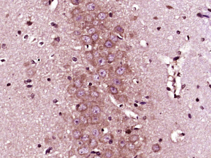 Paraformaldehyde-fixed, paraffin embedded Rat brain; Antigen retrieval by boiling in sodium citrate buffer (pH6.0) for 15min; Block endogenous peroxidase by 3% hydrogen peroxide for 20 minutes; Blocking buffer (normal goat serum) at 37°C for 30min; Antibody incubation with Pro-Neuregulin 1 Polyclonal Antibody, Unconjugated (bs-1814R) at 1:400 overnight at 4°C, DAB staining.