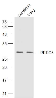 Lane 1: Mouse Cerebrum lysates; Lane 2: Mouse lung lysates probed with PRRG3 Polyclonal Antibody, Unconjugated (bs-19427R) at 1:300 dilution and 4˚C overnight incubation. Followed by conjugated secondary antibody incubation at 1:20000 for 60 min at 37˚C.