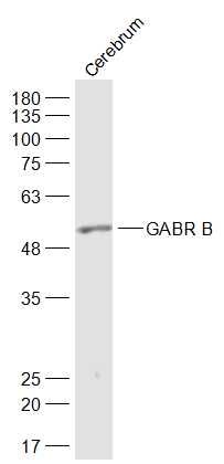 Mouse Cerebrum lysates probed with GABRB3 Polyclonal Antibody, unconjugated (bs-8544R) at 1:1000 overnight at 4°C followed by a conjugated secondary antibody at 1:10000 for 90 minutes at 37°C.