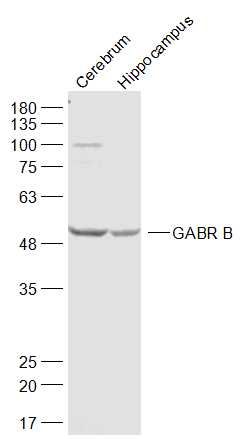 Lane 1: Mouse Cerebrum, Lane 2: Mouse Hippocampus; Probed with GABRB3 Polyclonal Antibody, unconjugated (bs-8544R) at 1:1000 overnight at 4°C followed by a conjugated secondary antibody at 1:20000 for 90 minutes at 37°C.