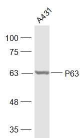 Lane 1: A431 Cell lysates; Probed with P63 Polyclonal Antibody, unconjugated (bs-0723R) at 1:1000 overnight at 4\u00b0C followed by a conjugated secondary antibody for 60 minutes at 37\u00b0C.