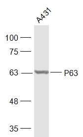 Lane 1: A431 Cell lysates; Probed with P63 Polyclonal Antibody, unconjugated (bs-0723R) at 1:1000 overnight at 4°C followed by a conjugated secondary antibody for 60 minutes at 37°C.