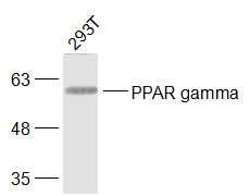 293T Cells probed with PPAR gamma Polyclonal Antibody, unconjugated (bs-0530R) at 1:1000 overnight at 4°C followed by a conjugated secondary antibody at 1:20000 for 60 minutes at 37°C.