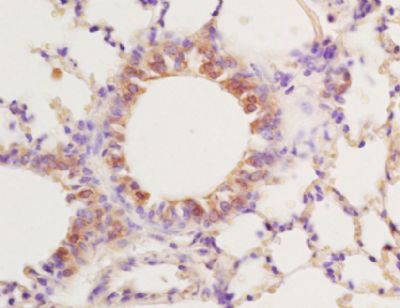 Formalin-fixed and paraffin-embedded Mouse lung tissue labeled with Rabbit Anti- PPARr gamma Polyclonal Antibody, Unconjugated (bs-0530R) at 1:200 followed by conjugation to the secondary antibody and DAB staining