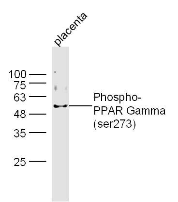 Lane 1: Mouse Placenta lysates; Probed with PPAR Gamma (Ser273) Polyclonal Antibody, unconjugated (bs-4888R) at 1:300 overnight at 4°C followed by a conjugated secondary antibody for 60 minutes at 37°C.
