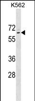 K562 Cell Lysate (35ug); Probed with TP63 (3C3) Monoclonal Antibody, Unconjugated (bsm-51191M) at 1:800 overnight at 4°C followed by a conjugated secondary antibody for 60 minutes at 37°C.