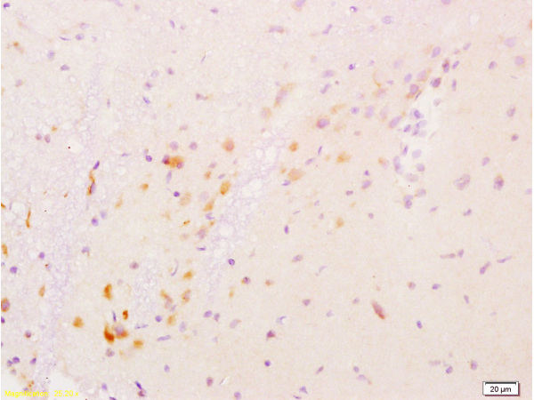 Formalin-fixed and paraffin embedded rat brain labeled with Anti-GDNF Polyclonal Antibody, Unconjugated (bs-1024R) at 1:200 followed by conjugation to the secondary antibody and DAB staining.