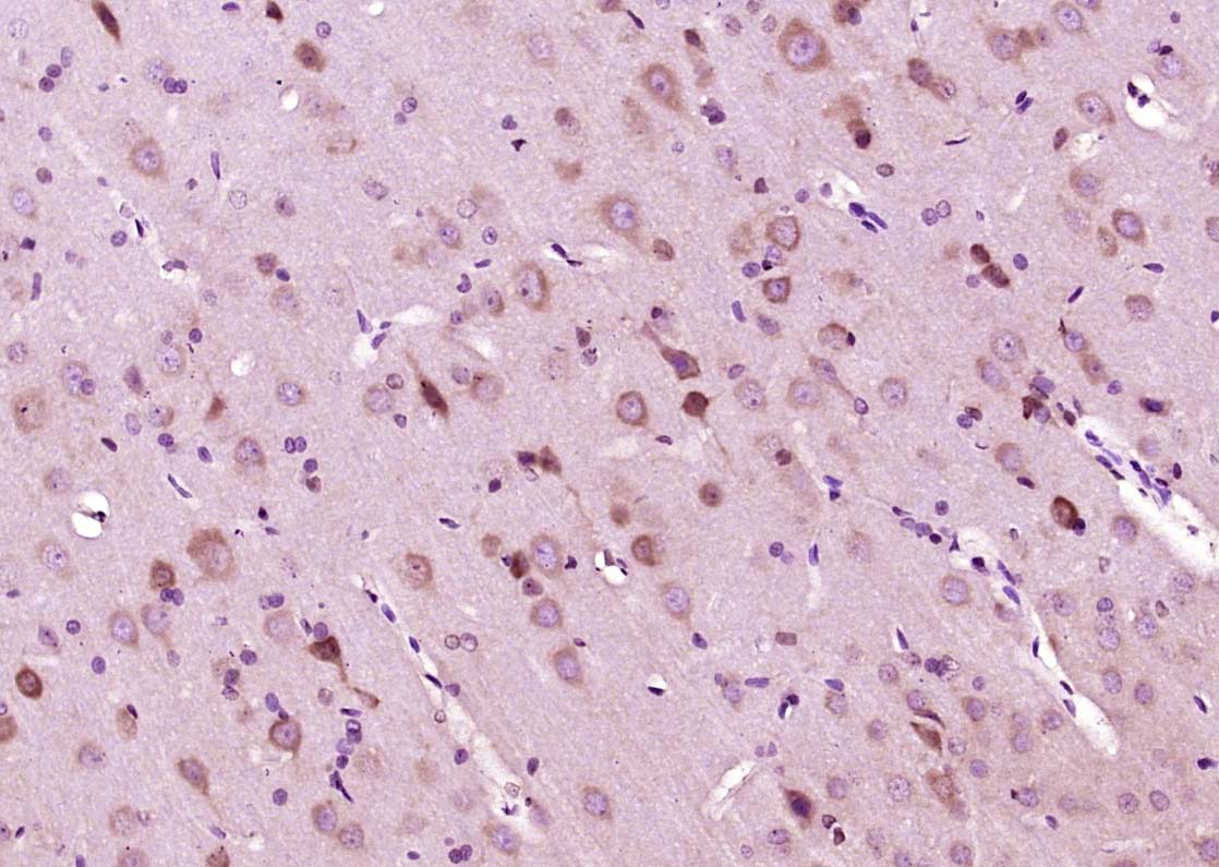 Paraformaldehyde-fixed, paraffin embedded Rat brain; Antigen retrieval by boiling in sodium citrate buffer (pH6.0) for 15min; Block endogenous peroxidase by 3% hydrogen peroxide for 20 minutes; Blocking buffer (normal goat serum) at 37°C for 30min; Antibody incubation with MEK6 (Ser207) Polyclonal Antibody, Unconjugated (bs-3275R) at 1:400 overnight at 4°C, DAB staining.