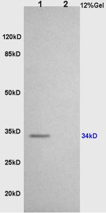 L1 rat brain lysates L2 rat heart lysates probed with Anti CD86/B7-2 Polyclonal Antibody, Unconjugated (bs-1035R) at 1:200 overnight at 4˚C. Followed by conjugation to secondary antibody (bs-0295G-HRP) at 1:3000 for 90 min at 37˚C. Predicted band 34kD. Observed band size:34kD.