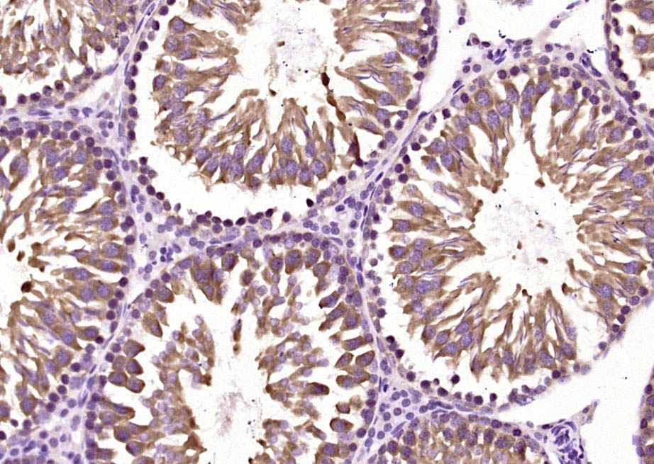 Paraformaldehyde-fixed, paraffin embedded Rat testis; Antigen retrieval by boiling in sodium citrate buffer (pH6.0) for 15min; Block endogenous peroxidase by 3% hydrogen peroxide for 20 minutes; Blocking buffer (normal goat serum) at 37°C for 30min; Antibody incubation with Rad51 Polyclonal Antibody, Unconjugated (bs-20297R) at 1:400 overnight at 4°C, DAB staining. Paraformaldehyde-fixed, paraffin embedded Rat testis; Antigen retrieval by boiling in sodium citrate buffer (pH6.0) for 15min; Block endogenous peroxidase by 3% hydrogen peroxide for 20 minutes; Blocking buffer (normal goat serum) at 37°C for 30min; Antibody incubation with Rad51 Polyclonal Antibody, Unconjugated (bs-20297R) at 1:400 overnight at 4°C, DAB staining.
