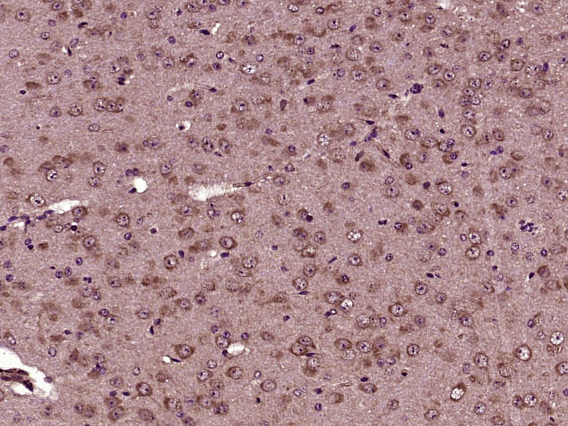 Paraformaldehyde-fixed, paraffin embedded Mouse brain; Antigen retrieval by boiling in sodium citrate buffer (pH6.0) for 15min; Block endogenous peroxidase by 3% hydrogen peroxide for 20 minutes; Blocking buffer (normal goat serum) at 37°C for 30min; Antibody incubation with AKT (Ser473)(9H11) Monoclonal Antibody, Unconjugated (bsm-33281M) at 1:2000 overnight at 4°C, followed by a conjugated secondary  for 20 minutes and DAB staining.
