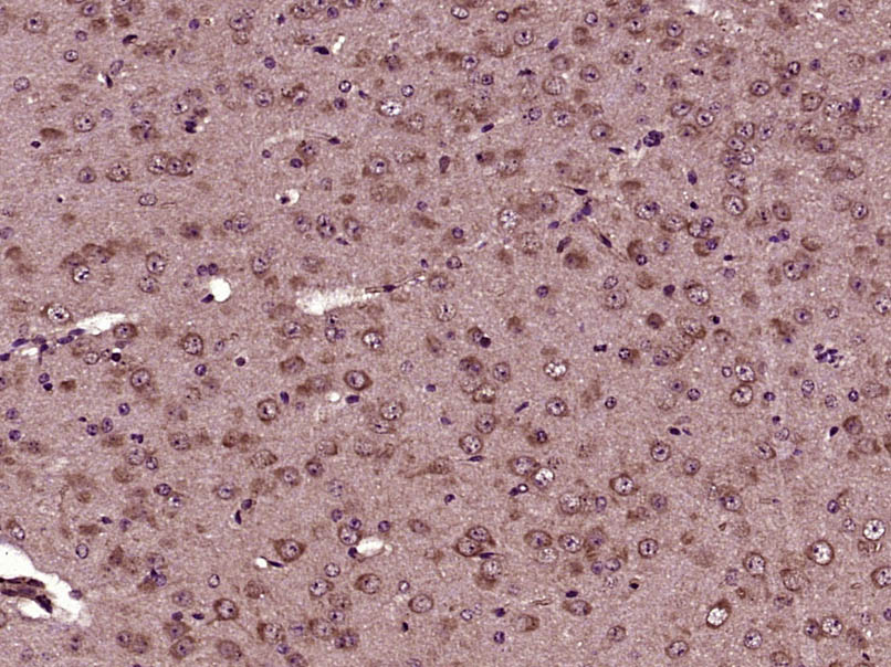 Paraformaldehyde-fixed, paraffin embedded Mouse brain; Antigen retrieval by boiling in sodium citrate buffer (pH6.0) for 15min; Block endogenous peroxidase by 3% hydrogen peroxide for 20 minutes; Blocking buffer (normal goat serum) at 37°C for 30min; Antibody incubation with AKT (Ser473)(9H11) Monoclonal Antibody, Unconjugated (bsm-33281M) at 1:2000 overnight at 4°C, followed by a conjugated secondary for 20 minutes and DAB staining.