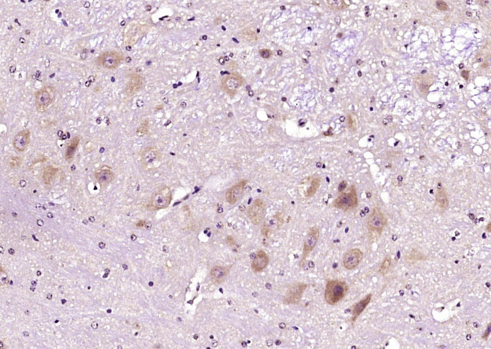 Paraformaldehyde-fixed, paraffin embedded Mouse cerebellum; Antigen retrieval by boiling in sodium citrate buffer (pH6.0) for 15min; Block endogenous peroxidase by 3% hydrogen peroxide for 20 minutes; Blocking buffer (normal goat serum) at 37°C for 30min; Antibody incubation with SEMA6D Polyclonal Antibody, Unconjugated (bs-2943R) at 1:400 overnight at 4°C, DAB staining.