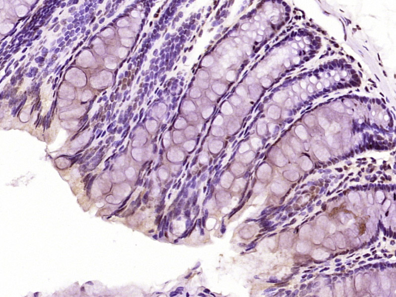 Paraformaldehyde-fixed, paraffin embedded Mouse colon; Antigen retrieval by boiling in sodium citrate buffer (pH6.0) for 15min; Block endogenous peroxidase by 3% hydrogen peroxide for 20 minutes; Blocking buffer (normal goat serum) at 37°C for 30min; Antibody incubation with MAPK8 ( Thr183 + Tyr185) Polyclonal Antibody, Unconjugated (bs-5487R) at 1:400 overnight at 4°C, DAB staining.